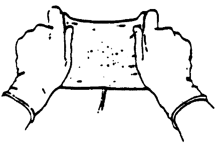 Procedure Principles for Dressing Change of CVL procedure illustration