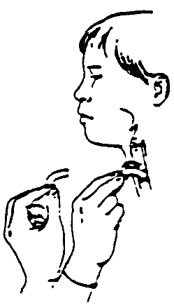 Procedure to Change a Tracheostomy Tube in an Emergency procedure illustration