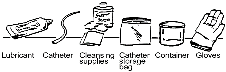 Procedure for Clean Intermittent Catheterization – Female: procedure illustration